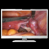 Медичний монітор Hisense HME8C32, фото 2
