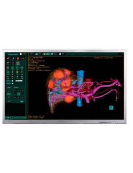 Медичний монітор Hisense HME8C55E