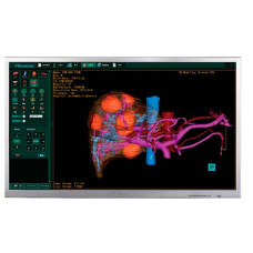 Медичний монітор Hisense HME8C55S