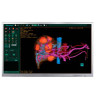 Медичний монітор Hisense HME8C55S, фото 1