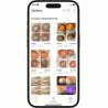 Оптична система Custom Surgical MicroREC, фото 5