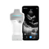 Ультрапортативная УЗИ система Vscan Air™SL Ультрапортативная УЗИ система Vscan Air™SL, фото 5