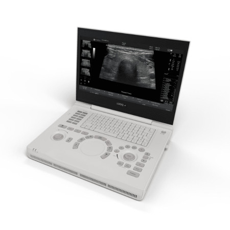 УЗД апарати GE Healthcare LOGIQ E